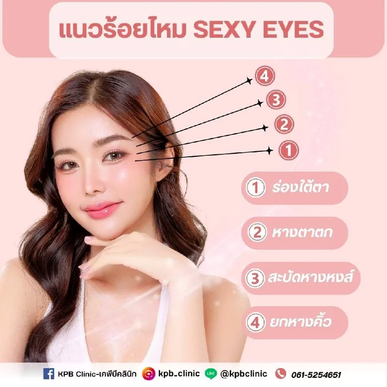 การเตรียมตัวและการดูแลหลังร้อยไหม