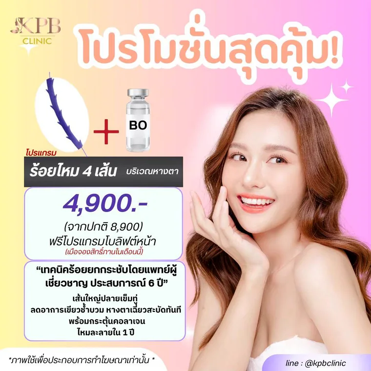 โปรโมชันร้อยไหมบริเวณหางตา KPB Clinic
